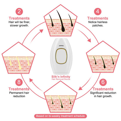 SOUQSPOT ᵀᴹ IPL Hair Remover