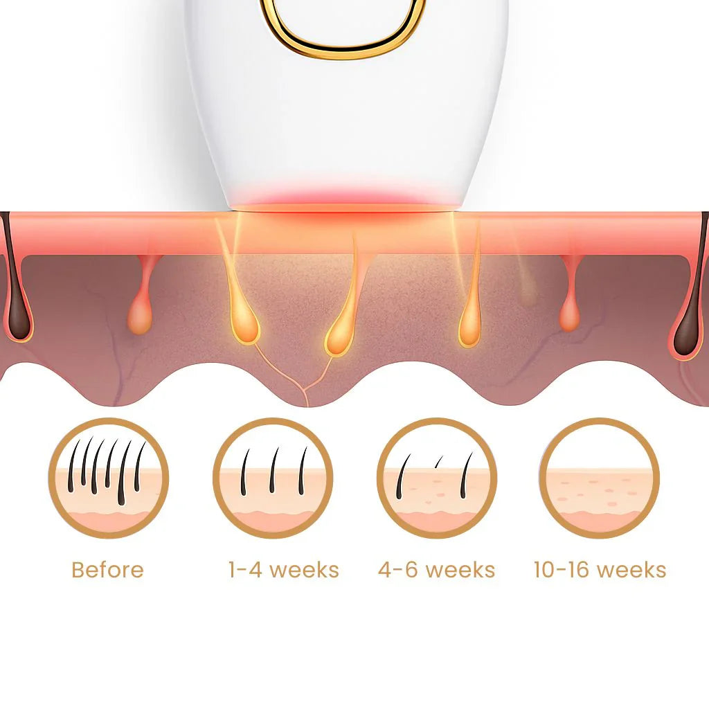 SOUQSPOT ᵀᴹ IPL Hair Remover