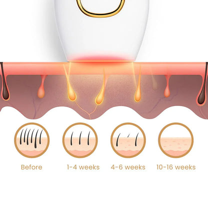 SOUQSPOT ᵀᴹ IPL Hair Remover